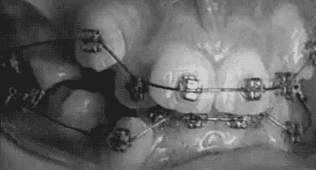 what_is_orthodontics