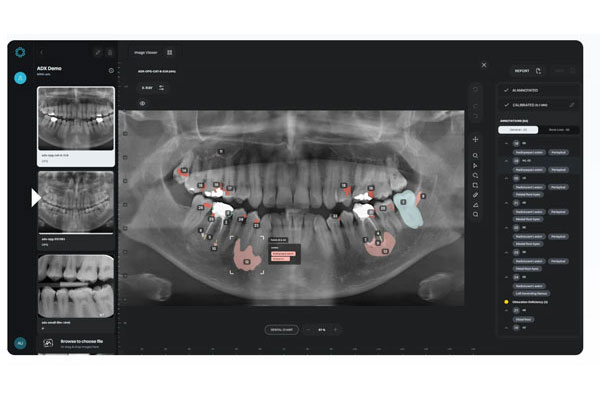 ai-in-orthodontics