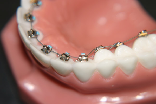 what is orthodontics