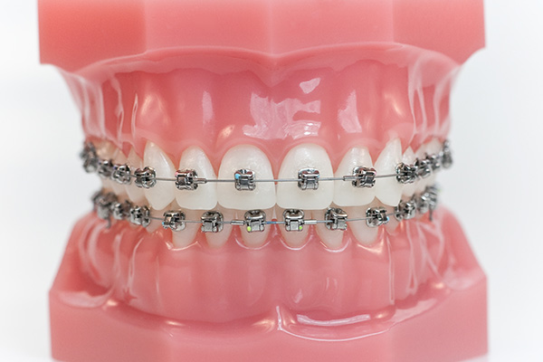 brackets